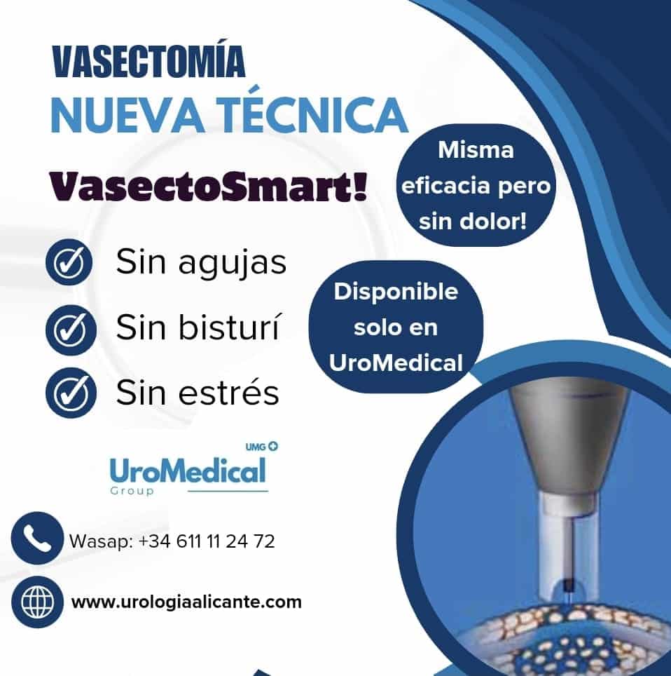 Nueva técnica: Vasectomía